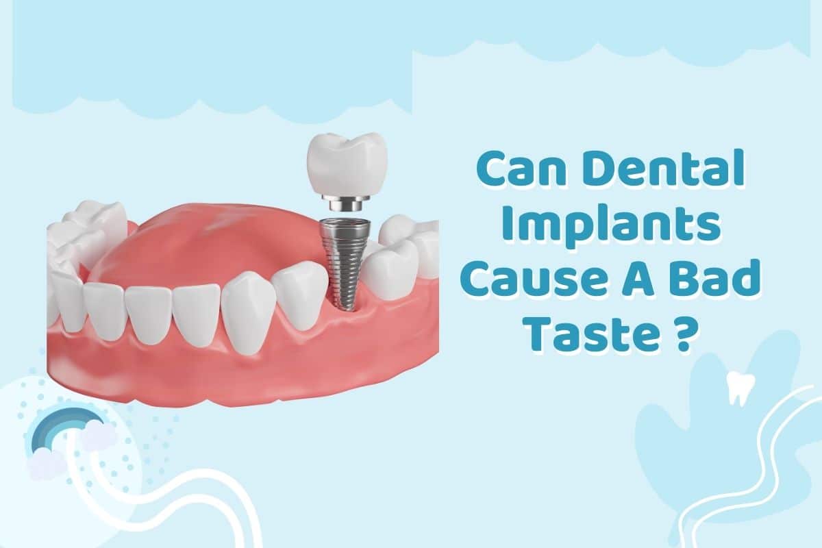 Dental implants San Diego