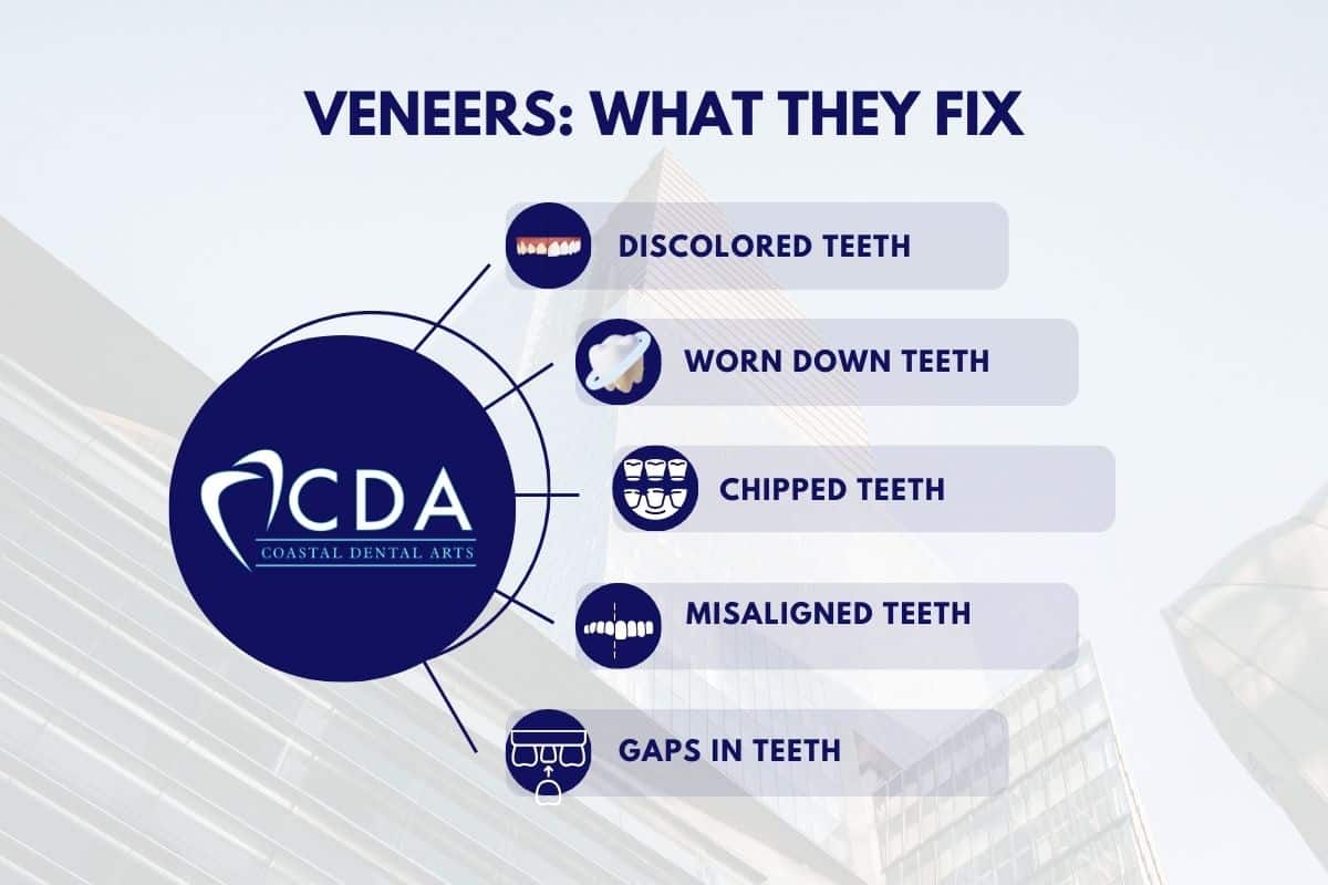 Veneers