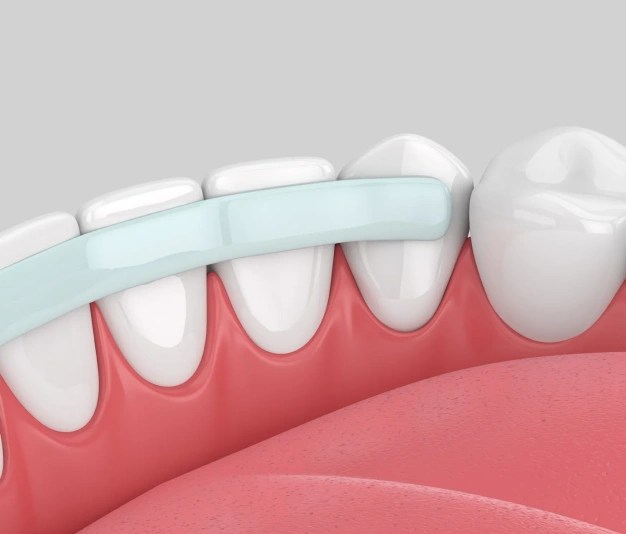 Animated dental illustration showing white teeth with pink gums and a light blue gum line indicator.