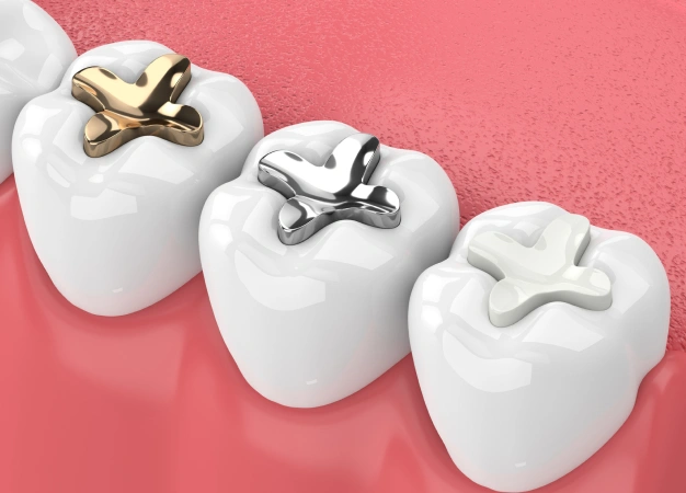 Three white tooth models displaying gold and silver dental crowns against pink background.